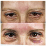 Micropigmentación en Cejas en Barcelona 79