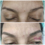 Micropigmentación en Cejas en Barcelona 42