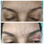 Micropigmentación en Cejas en Barcelona 47