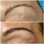 Micropigmentación en Cejas en Barcelona 35