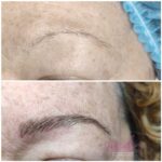 Micropigmentación en Cejas en Barcelona 39
