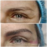 Micropigmentación en Cejas en Barcelona 7