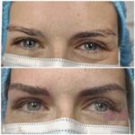 Micropigmentación en Cejas en Barcelona 40