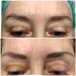 Micropigmentación en Cejas en Barcelona 51