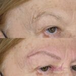 Micropigmentación en Cejas en Barcelona 101