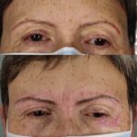 Micropigmentación en Cejas en Barcelona 102
