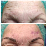 Micropigmentación en Cejas en Barcelona 33