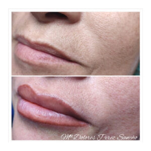 Micropigmentación en Labios en Barcelona 4