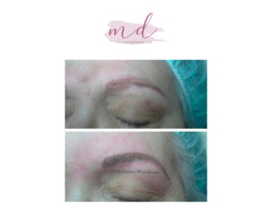 Micropigmentación facial: Correcciones 18