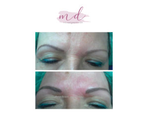 Micropigmentación facial: Correcciones 11