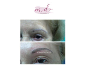 Micropigmentación facial: Correcciones 9