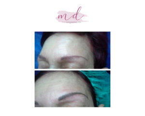 Micropigmentación facial: Correcciones 7