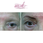 Micropigmentación en Cejas en Barcelona 86