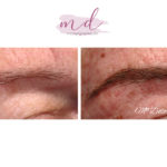 Micropigmentación en Cejas en Barcelona 91